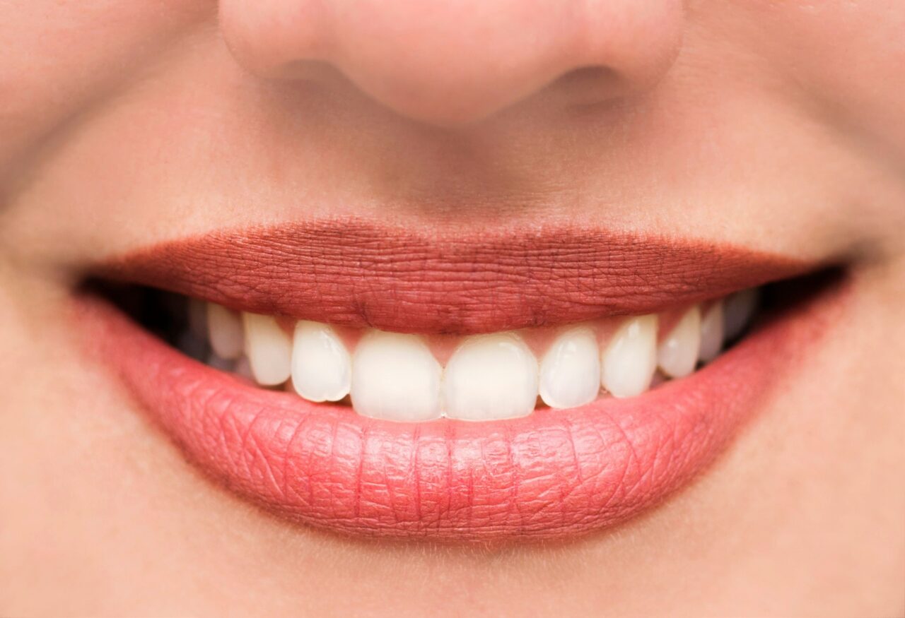 woman-s-lips-and-teeth-smile-close-up
