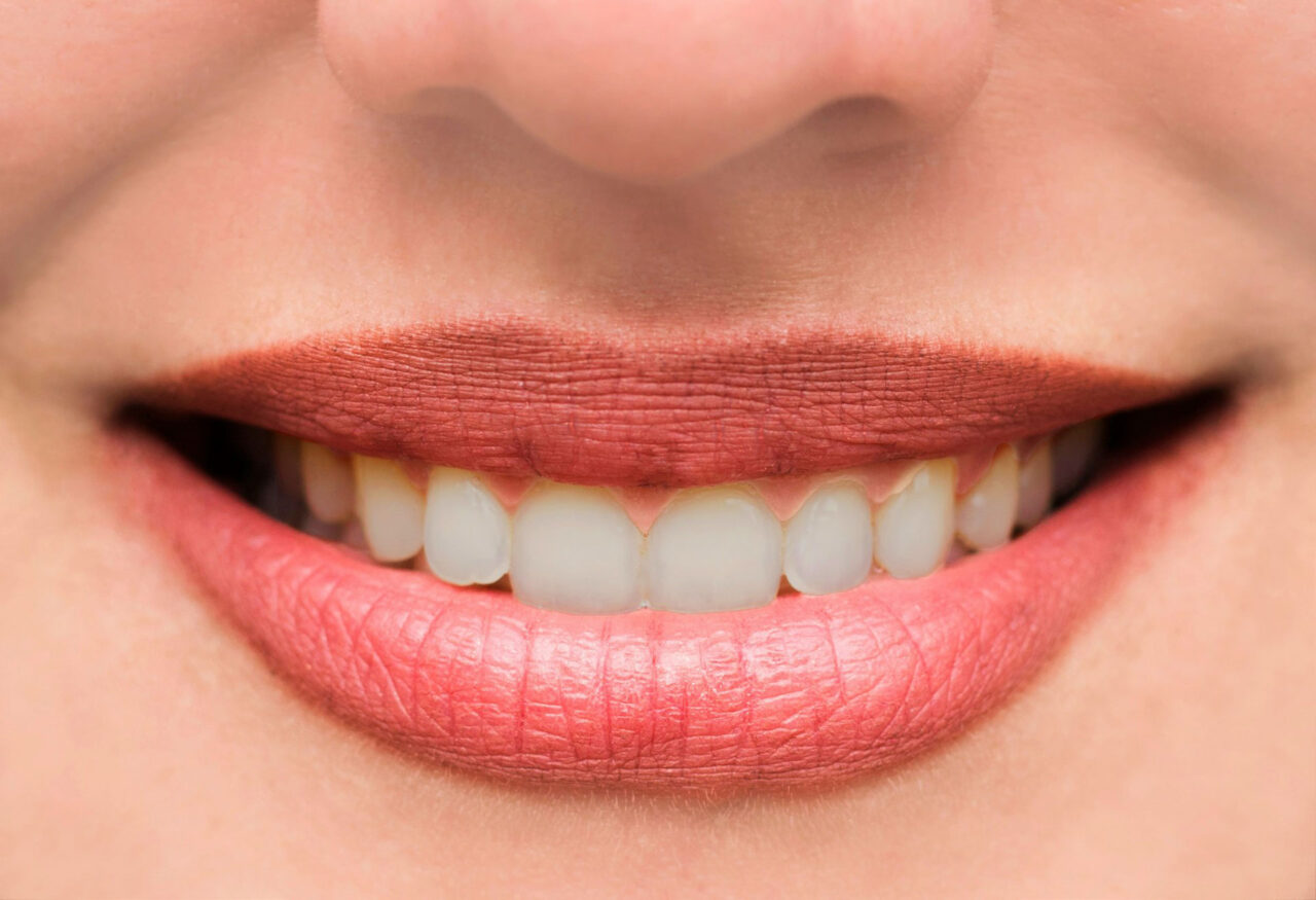 woman-s-lips-and-teeth-smile-close-up3